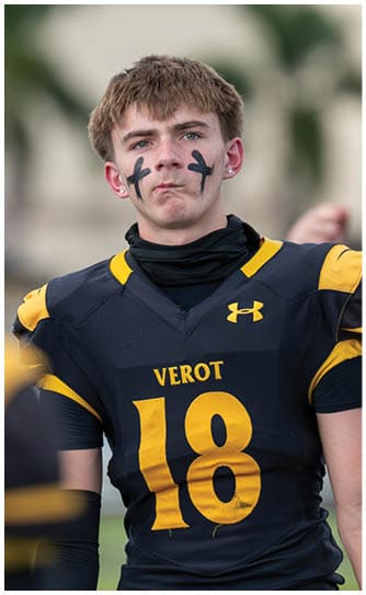 Person with short hair wearing a dark sports jersey with yellow accents and black face paint under both eyes looks thoughtful or concerned. Descripci n generada con IA