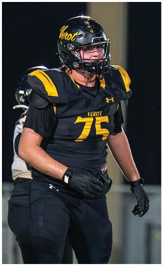 A person wearing a black and yellow football uniform with the number 75 and the word Verot on the jersey is standing on a football field during a game. Descripci n generada con IA
