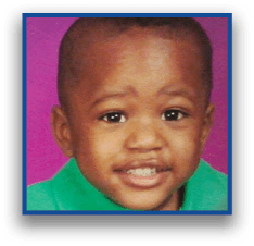 Close-up of a child's forehead and eyes with a blue border around the image. Description generated by AI