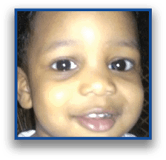 Close-up of a child's eyes and forehead with curly hair visible at the top. Description generated by AI
