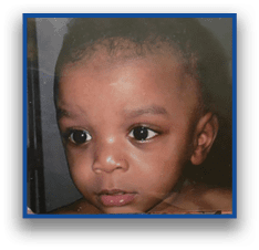 A close-up of a child with short hair looking slightly to the side with a neutral expression. Description generated by AI