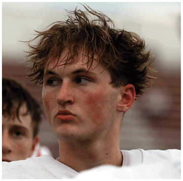 A person with messy, tousled hair is looking to the side against a blurred outdoor background. Description generated by AI